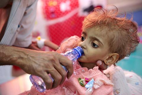 yemeni famine could be one of worst: un - taipei times