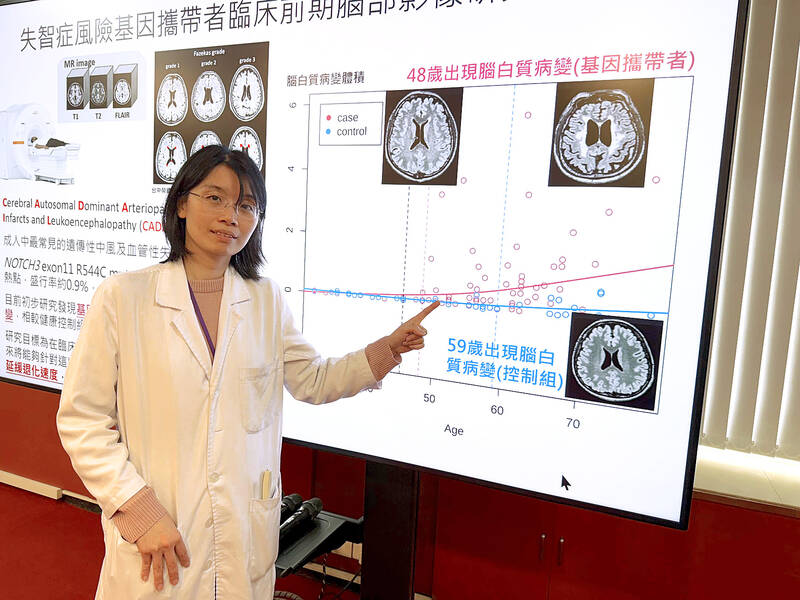 Gene variation leads to higher risk of dementia